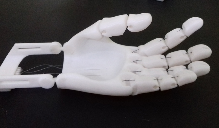 Extending a 3D-printed prosthetic arm of love- The Week